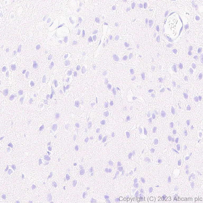 Immunohistochemistry (Formalin/PFA-fixed paraffin-embedded sections) - Anti-Histone H2B (mutated E76K) antibody [EPR27298-41] (AB313789)