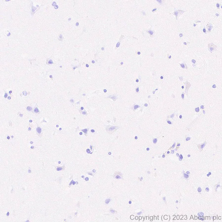 Immunohistochemistry (Formalin/PFA-fixed paraffin-embedded sections) - Anti-Histone H2B (mutated E76K) antibody [EPR27298-41] - BSA and Azide free (AB313790)