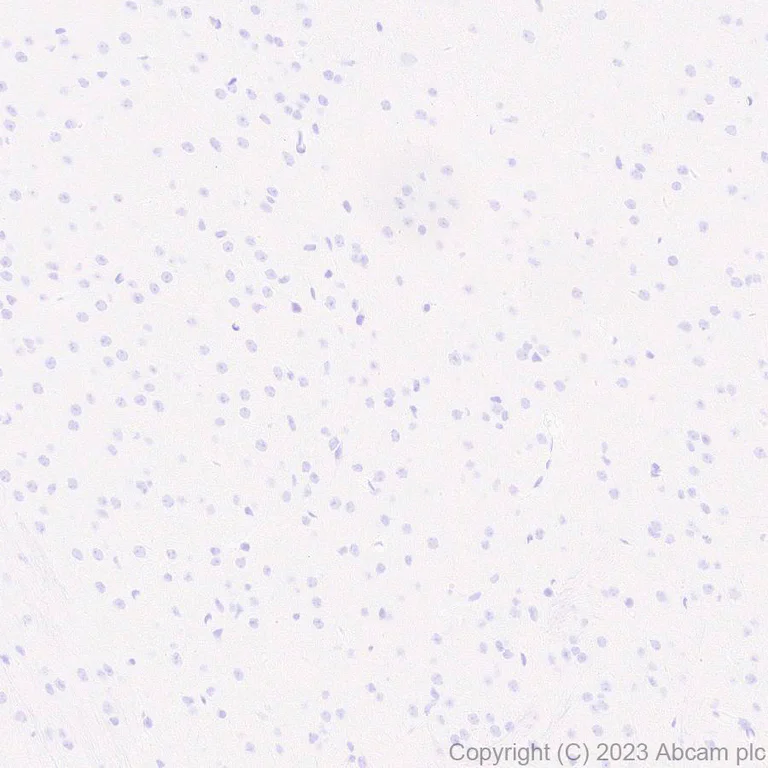 Immunohistochemistry (Formalin/PFA-fixed paraffin-embedded sections) - Anti-Histone H2B (mutated E76K) antibody [EPR27298-41] - BSA and Azide free (AB313790)