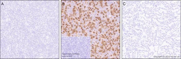 Immunohistochemistry (Formalin/PFA-fixed paraffin-embedded sections) - Anti-Histone H2B (mutated E76Q) antibody [EPR27299-85] - BSA and Azide free (AB309101)