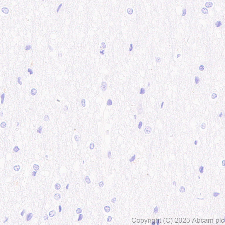 Immunohistochemistry (Formalin/PFA-fixed paraffin-embedded sections) - Anti-Histone H2B (mutated E76Q) antibody [EPR27299-85] - BSA and Azide free (AB309101)