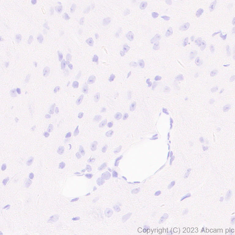 Immunohistochemistry (Formalin/PFA-fixed paraffin-embedded sections) - Anti-Histone H2B (mutated E76Q) antibody [EPR27299-85] - BSA and Azide free (AB309101)