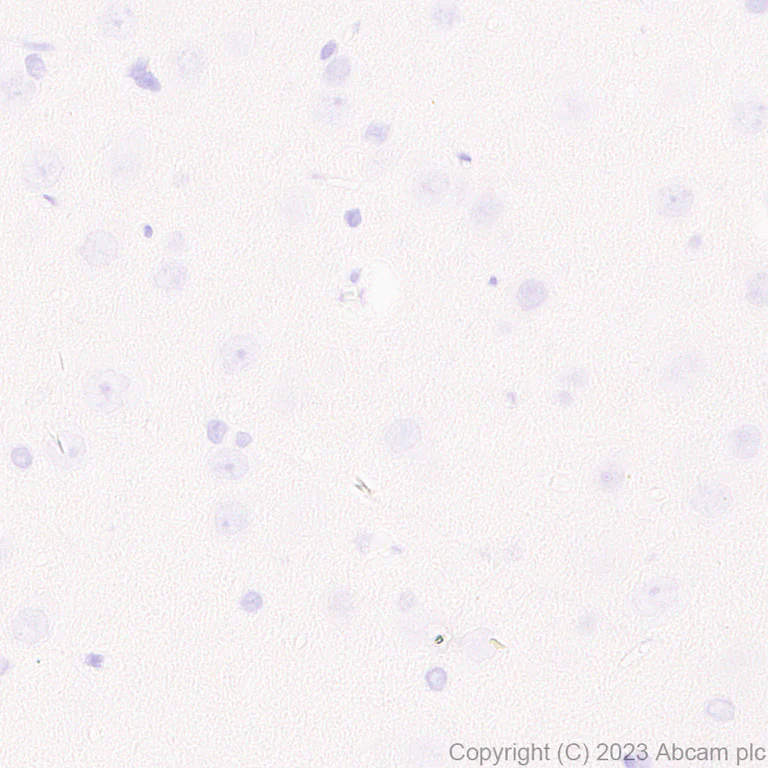 Immunohistochemistry (Formalin/PFA-fixed paraffin-embedded sections) - Anti-Histone H2B (mutated E76Q) antibody [EPR27299-85] - BSA and Azide free (AB309101)