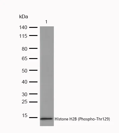 Western blot - Anti-Histone H2B (phospho T129) antibody [SR1184] (AB326646)