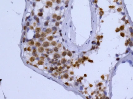 Immunohistochemistry (Formalin/PFA-fixed paraffin-embedded sections) - Anti-Histone H2B (testis specific) antibody [EPR12881] - BSA and Azide free (AB250047)