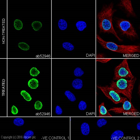 Immunocytochemistry/ Immunofluorescence - Anti-Histone H3 (acetyl K14) antibody [EP964Y] - BSA and Azide free (AB203952), expandable thumbnail