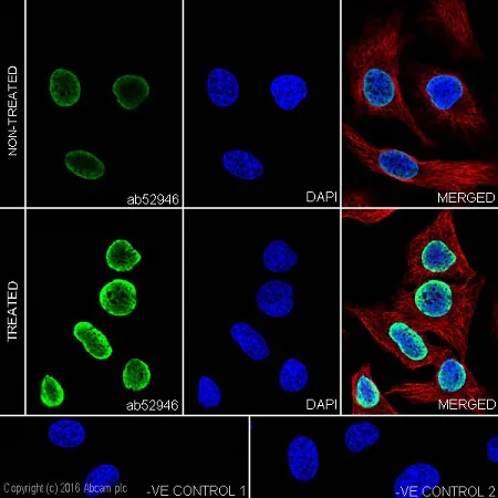 Immunocytochemistry/ Immunofluorescence - Anti-Histone H3 (acetyl K14) antibody [EP964Y] - BSA and Azide free (AB203952)