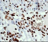 Immunohistochemistry (Formalin/PFA-fixed paraffin-embedded sections) - Anti-Histone H3 (acetyl K14) antibody [EP964Y] - BSA and Azide free (AB203952), expandable thumbnail