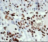 Immunohistochemistry (Formalin/PFA-fixed paraffin-embedded sections) - Anti-Histone H3 (acetyl K14) antibody [EP964Y] - BSA and Azide free (AB203952)