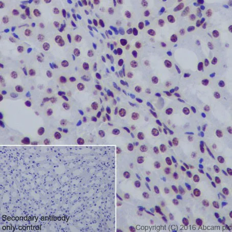 Immunohistochemistry (Formalin/PFA-fixed paraffin-embedded sections) - Anti-Histone H3 (acetyl K14) antibody [EP964Y] - ChIP Grade (AB52946)