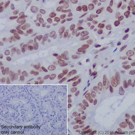 Immunohistochemistry (Formalin/PFA-fixed paraffin-embedded sections) - Anti-Histone H3 (acetyl K14) antibody [EP964Y] - ChIP Grade (AB52946), expandable thumbnail