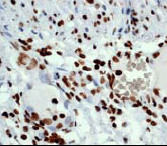 Immunohistochemistry (Formalin/PFA-fixed paraffin-embedded sections) - Anti-Histone H3 (acetyl K14) antibody [EP964Y] - ChIP Grade (ab52946), expandable thumbnail