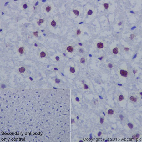 Immunohistochemistry (Formalin/PFA-fixed paraffin-embedded sections) - Anti-Histone H3 (acetyl K14) antibody [EP964Y] - ChIP Grade (AB52946), expandable thumbnail