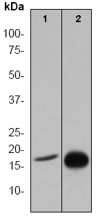 Western blot - Anti-Histone H3 (acetyl K14) antibody [EP964Y] - ChIP Grade (ab52946), expandable thumbnail