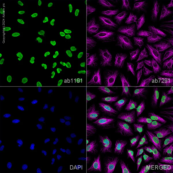 Immunocytochemistry/ Immunofluorescence - Anti-Histone H3 (acetyl K18) antibody - ChIP Grade (AB1191)