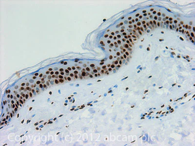 Immunohistochemistry (Formalin/PFA-fixed paraffin-embedded sections) - Anti-Histone H3 (acetyl K18) antibody - ChIP Grade (AB1191)