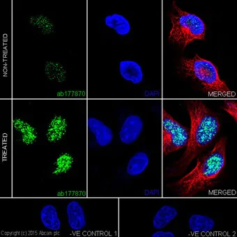 Immunocytochemistry/ Immunofluorescence - Anti-Histone H3 (acetyl K18) antibody [EPR16595] - ChIP Grade (AB177870)