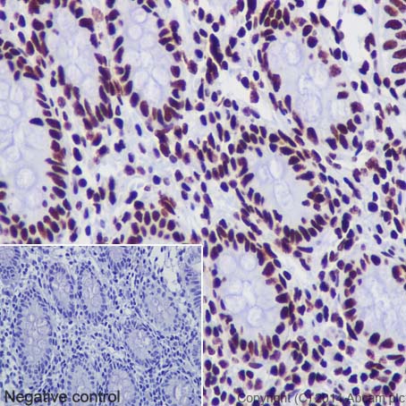 Immunohistochemistry (Formalin/PFA-fixed paraffin-embedded sections) - Anti-Histone H3 (acetyl K18) antibody [EPR16595] - ChIP Grade (AB177870)