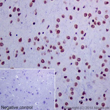 Immunohistochemistry (Formalin/PFA-fixed paraffin-embedded sections) - Anti-Histone H3 (acetyl K18) antibody [EPR16595] - ChIP Grade (AB177870)