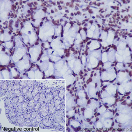 Immunohistochemistry (Formalin/PFA-fixed paraffin-embedded sections) - Anti-Histone H3 (acetyl K18) antibody [EPR16595] - ChIP Grade (AB177870)