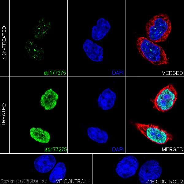 Immunocytochemistry/ Immunofluorescence - Anti-Histone H3 (acetyl K23) antibody [EPR17712] - BSA and Azide free (AB232434)