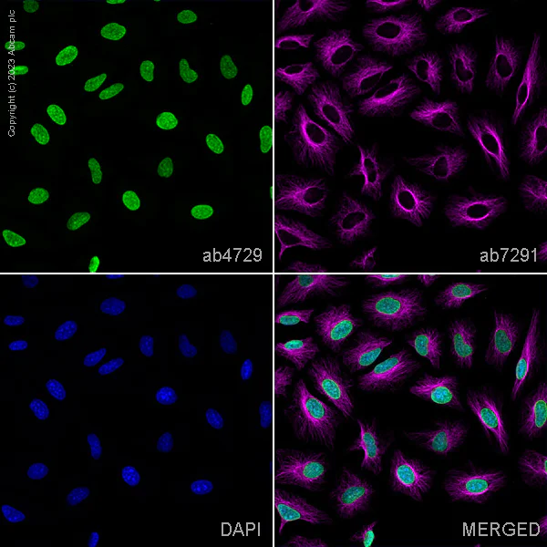Immunocytochemistry/ Immunofluorescence - Anti-Histone H3 (acetyl K27) antibody - ChIP Grade (AB4729)