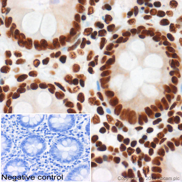 Immunohistochemistry (Formalin/PFA-fixed paraffin-embedded sections) - Anti-Histone H3 (acetyl K27) antibody - ChIP Grade (AB4729)