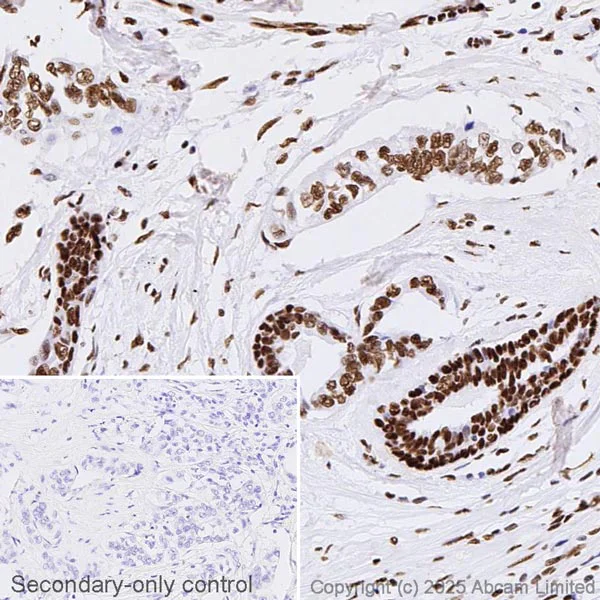 Immunohistochemistry (Formalin/PFA-fixed paraffin-embedded sections) - Anti-Histone H3 (acetyl K27) antibody - ChIP Grade (AB4729)