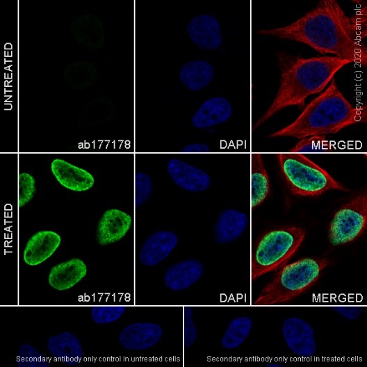 Immunocytochemistry/ Immunofluorescence - Anti-Histone H3 (acetyl K27) antibody [EP16602] - ChIP Grade (AB177178), expandable thumbnail