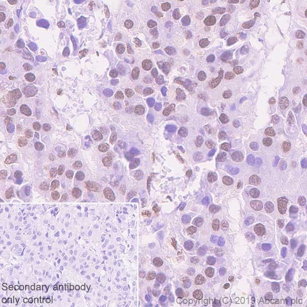 Immunohistochemistry (Formalin/PFA-fixed paraffin-embedded sections) - Anti-Histone H3 (acetyl K27) antibody [EP16602] - ChIP Grade (ab177178), expandable thumbnail