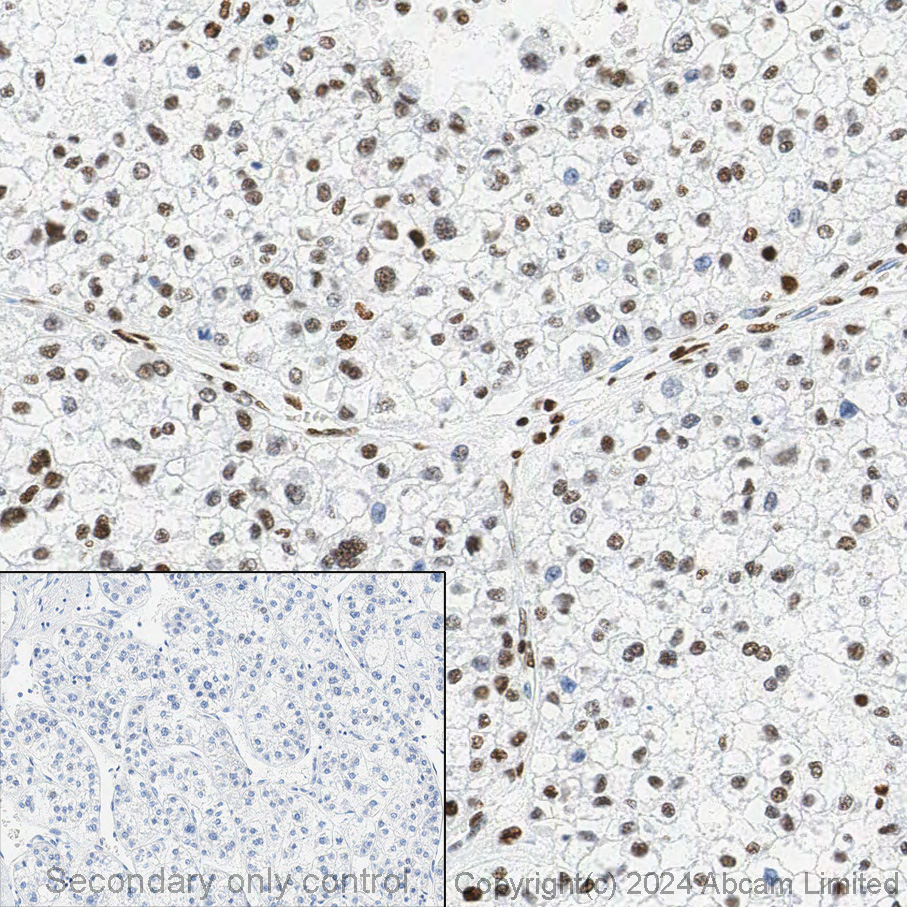 Immunohistochemistry (Formalin/PFA-fixed paraffin-embedded sections) - Anti-Histone H3 (acetyl K27) antibody [EP16602] - ChIP Grade (ab177178), expandable thumbnail