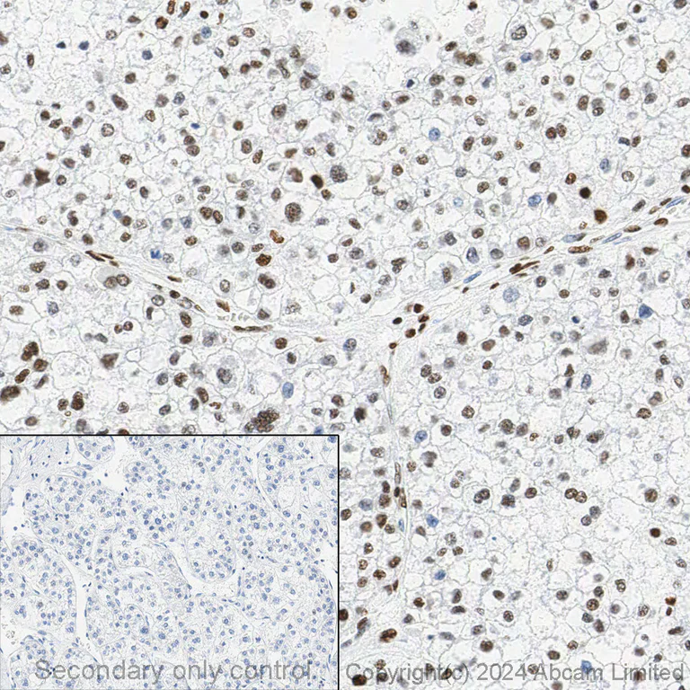 Immunohistochemistry (Formalin/PFA-fixed paraffin-embedded sections) - Anti-Histone H3 (acetyl K27) antibody [EP16602] - ChIP Grade - BSA and Azide free (AB302877)