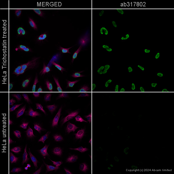 Immunocytochemistry/ Immunofluorescence - Anti-Histone H3 (acetyl K27) antibody [EP16602] – Ms IgG1 (Chimeric) – BSA and Azide Free (AB317802), expandable thumbnail