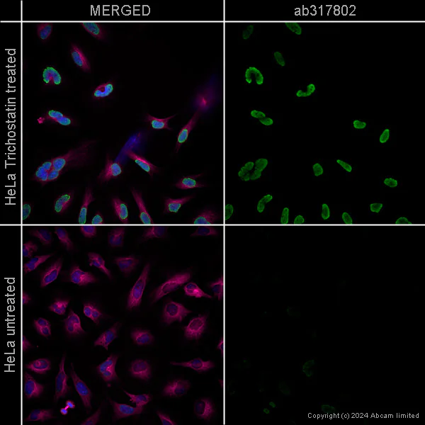 Immunocytochemistry/ Immunofluorescence - Anti-Histone H3 (acetyl K27) antibody [EP16602] – Ms IgG1 (Chimeric) – BSA and Azide Free (AB317802)