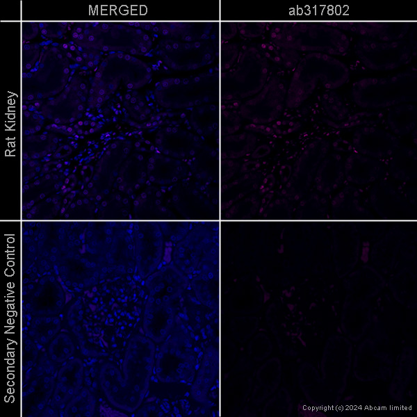 Immunohistochemistry (Formalin/PFA-fixed paraffin-embedded sections) - Anti-Histone H3 (acetyl K27) antibody [EP16602] – Ms IgG1 (Chimeric) – BSA and Azide Free (AB317802), expandable thumbnail