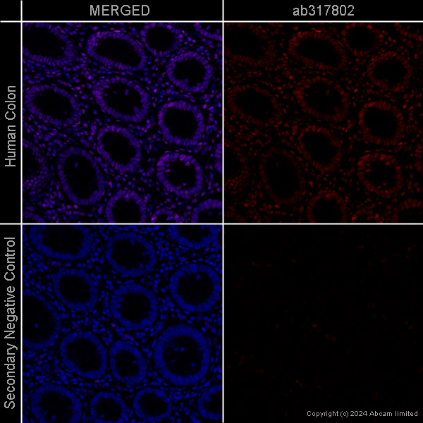 Immunohistochemistry (Formalin/PFA-fixed paraffin-embedded sections) - Anti-Histone H3 (acetyl K27) antibody [EP16602] – Ms IgG1 (Chimeric) – BSA and Azide Free (AB317802), expandable thumbnail
