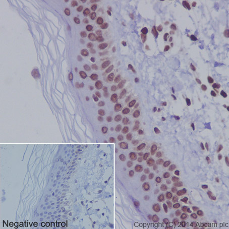 Immunohistochemistry (Formalin/PFA-fixed paraffin-embedded sections) - Anti-Histone H3 (acetyl K36) antibody [EPR16992] (AB177179), expandable thumbnail