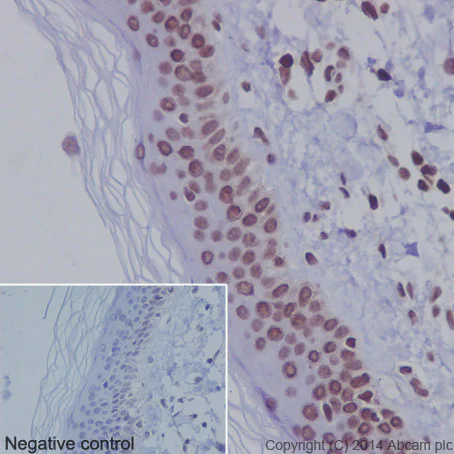 Immunohistochemistry (Formalin/PFA-fixed paraffin-embedded sections) - Anti-Histone H3 (acetyl K36) antibody [EPR16992] (AB177179)