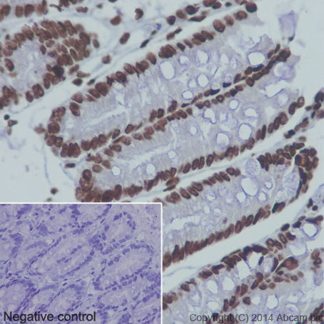 Immunohistochemistry (Formalin/PFA-fixed paraffin-embedded sections) - Anti-Histone H3 (acetyl K36) antibody [EPR16992] (AB177179), expandable thumbnail