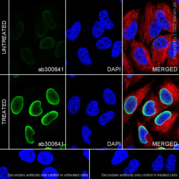 Immunocytochemistry/ Immunofluorescence - Anti-Histone H3 (acetyl K4+K9+K14+K18+K23+K27) antibody [RM1045] (AB300641)