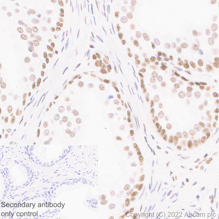Immunohistochemistry (Formalin/PFA-fixed paraffin-embedded sections) - Anti-Histone H3 (acetyl K4+K9+K14+K18+K23+K27) antibody [RM1045] (AB300641)