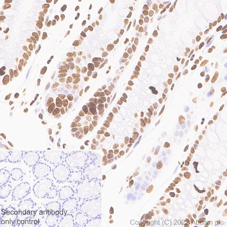 Immunohistochemistry (Formalin/PFA-fixed paraffin-embedded sections) - Anti-Histone H3 (acetyl K4+K9+K14+K18+K23+K27) antibody [RM1045] (AB300641)