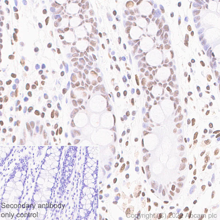 Immunohistochemistry (Formalin/PFA-fixed paraffin-embedded sections) - Anti-Histone H3 (acetyl K4+K9+K14+K18+K23+K27) antibody [RM1045] - BSA and Azide free (AB300642)