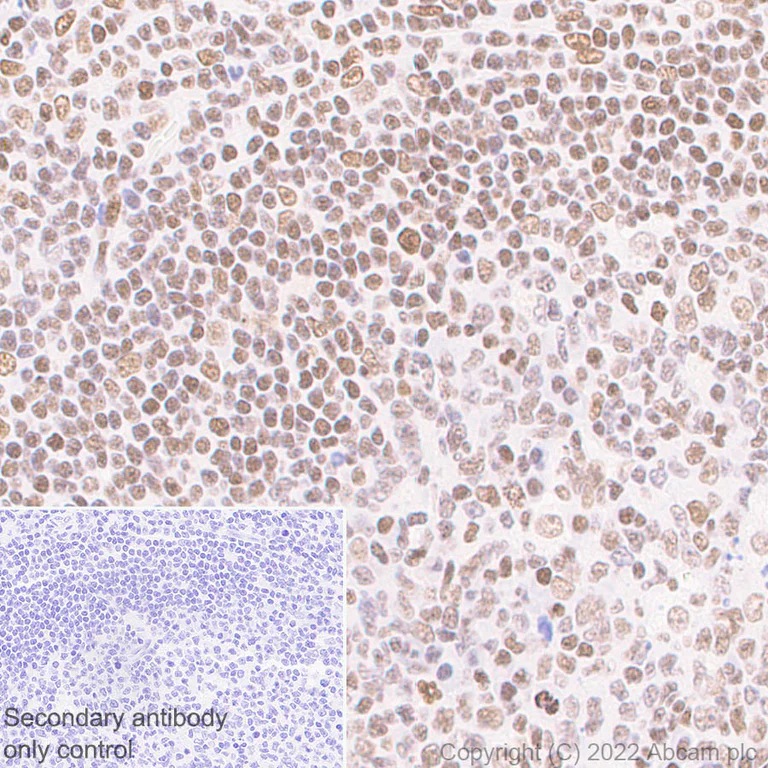 Immunohistochemistry (Formalin/PFA-fixed paraffin-embedded sections) - Anti-Histone H3 (acetyl K4+K9+K14+K18+K23+K27) antibody [RM1045] - BSA and Azide free (AB300642)