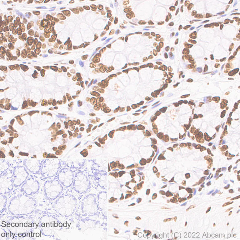 Immunohistochemistry (Formalin/PFA-fixed paraffin-embedded sections) - Anti-Histone H3 (acetyl K4+K9+K14+K18+K23+K27) antibody [RM1045] - BSA and Azide free (AB300642)