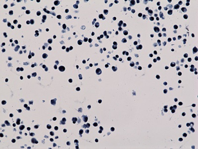 Immunocytochemistry/ Immunofluorescence - Anti-Histone H3 (acetyl K56) antibody [RM179] (AB238307)