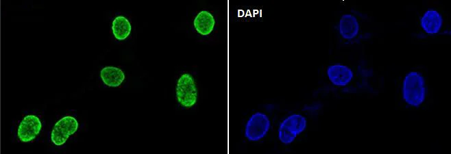 Immunocytochemistry/ Immunofluorescence - Anti-Histone H3 (acetyl K56) antibody [SR2687] (AB326692)