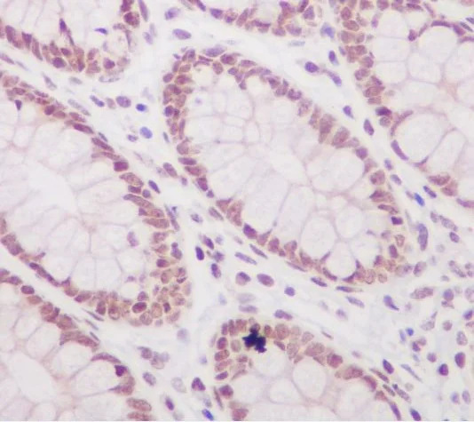 Immunohistochemistry (Formalin/PFA-fixed paraffin-embedded sections) - Anti-Histone H3 (acetyl K56) antibody [SR2687] (AB326692)