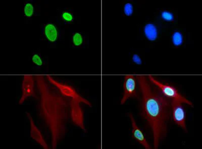 Immunocytochemistry/ Immunofluorescence - Anti-Histone H3 (acetyl K9) antibody (AB272150)