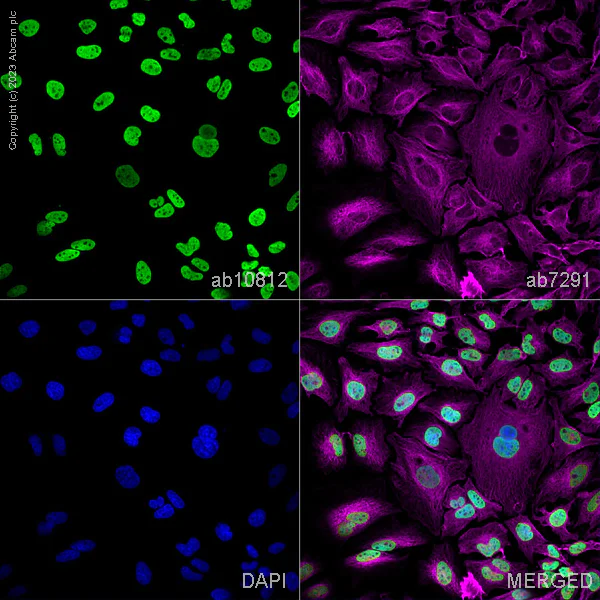 Immunocytochemistry/ Immunofluorescence - Anti-Histone H3 (acetyl K9) antibody - ChIP Grade (AB10812)